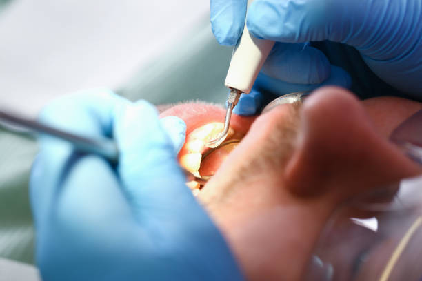 Best Walk-In Emergency Dentist in Forest Lake, IL