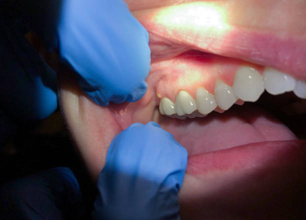 Best Weekend Emergency Dentist in Forest Lake, IL
