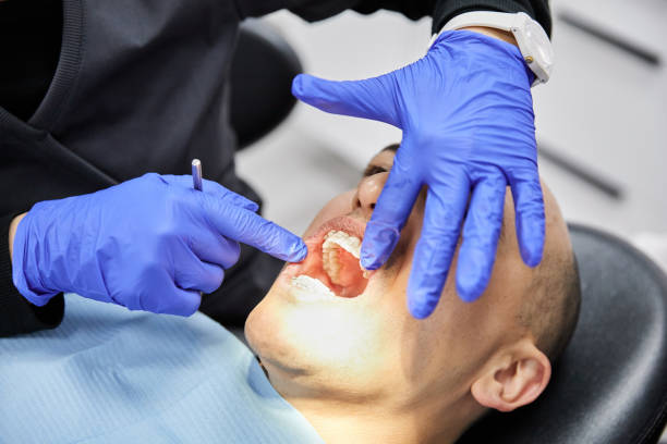 Best Emergency Tooth Extraction in Forest Lake, IL
